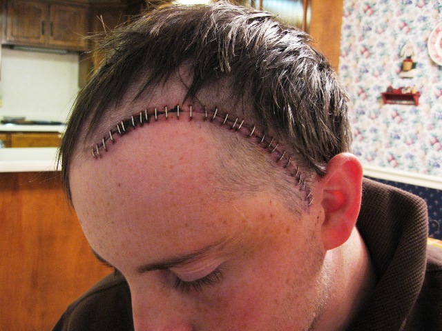 chris_staples_nov_2007.jpg
